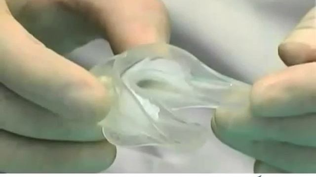 JOVIDENT Германия. Сиситема для домашнего отбеливания смотреть онлайн