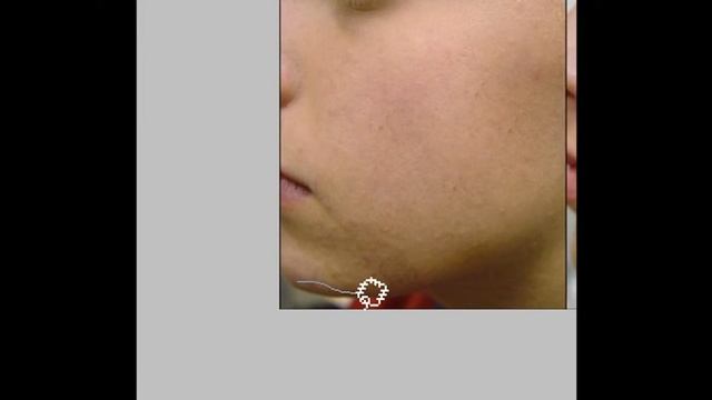 How to get rid of acne in Adobe Photoshop CS5 смотреть онлайн