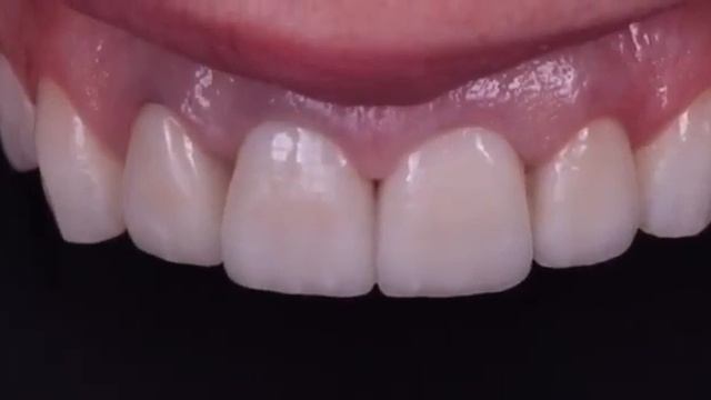 Отзывы стоматология в Махачкале смотреть онлайн