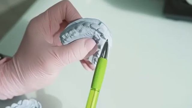 Раннее удаление молочных зубов?? смотреть онлайн