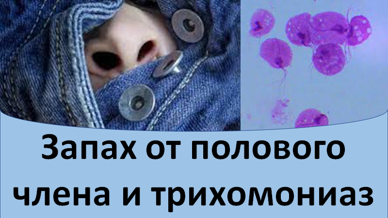 Запах от полового члена и трихомониаз смотреть онлайн