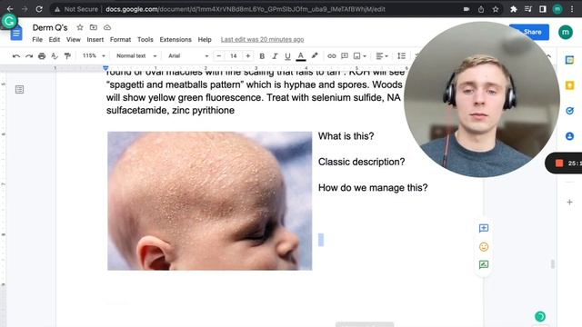 Dermatology Practice Questions | High Yield PANCE/EOR Prep (2) смотреть онлайн