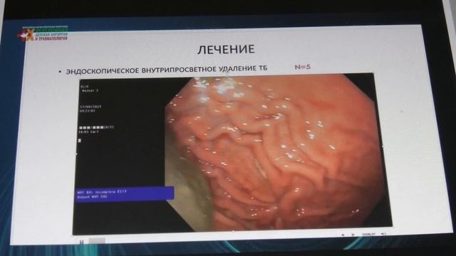 трихобезоары желудка смотреть онлайн