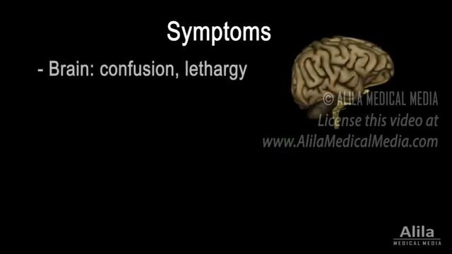 Hypercalcemia - Too Much Calcium, Animation смотреть онлайн