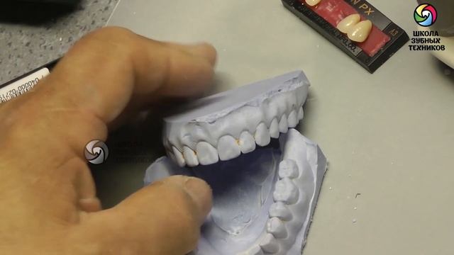 (ПСП 5) Лабораторный этап: Гипсование в артикулятор. Постановка передней группы зубов. смотреть онлайн