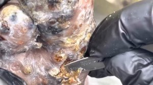 Augustine Panyako's dead, smelling jiggers - subscribe to our website and watch full video