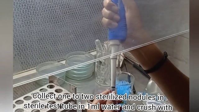 Isolation of Rhizobium from Root nodule #Isolation смотреть онлайн