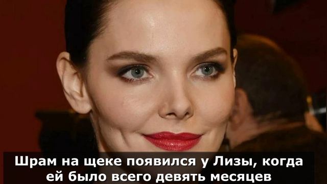 Знаменитости с внешними дефектами, которые стали их изюминкой смотреть онлайн