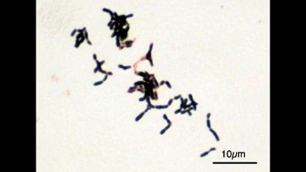 Бифидобактерии