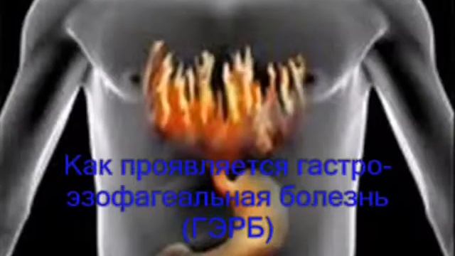 Все о торакальной хирургии Мурманска. Достижения и возможности. смотреть онлайн