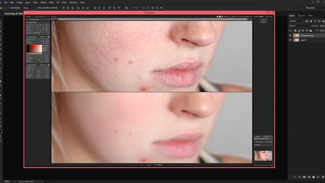 How To Remove Acne & Make Smooth Skin Using Portraiture In Photoshop CC (4K) || Surendra Devagan смотреть онлайн