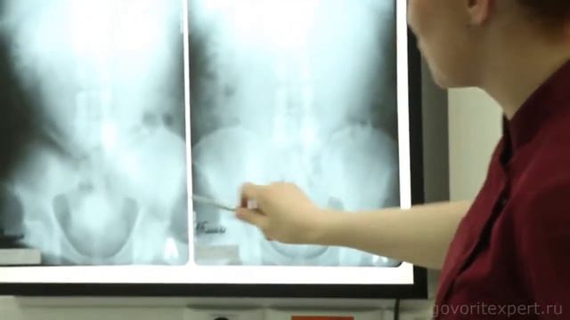 Лечение мужского бесплодия смотреть онлайн