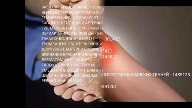 РЕВМАТИЧЕСКИЕ БОЛЕЗНИ - 8148888 смотреть онлайн