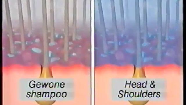 reclame - head and shoulders смотреть онлайн