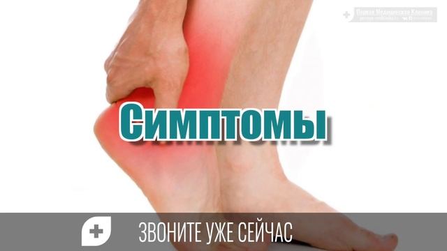 Пяточная шпора причины появления смотреть онлайн