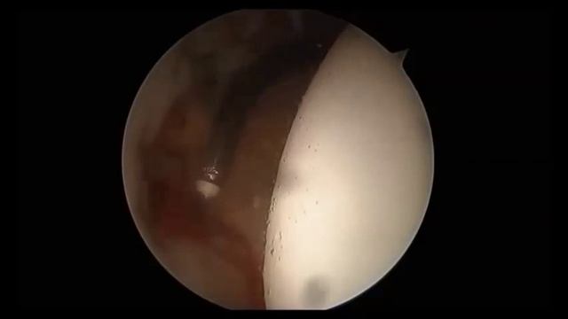 VAPR® ARCTIC™ смотреть онлайн