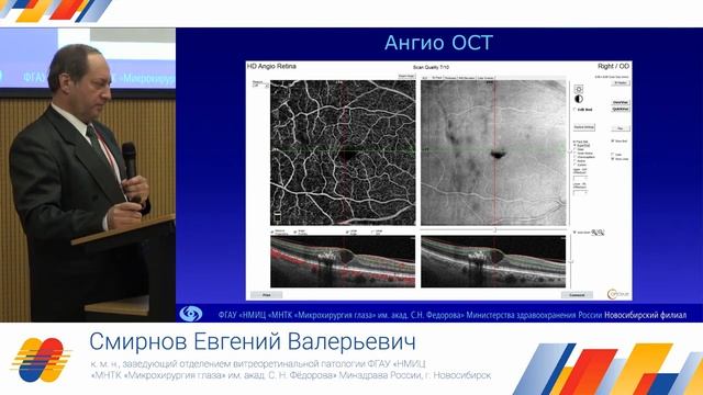 Офтальмологическая секция на III конференции "СД-2019: от мониторинга к управлению" 23-24.04.19 смотреть онлайн