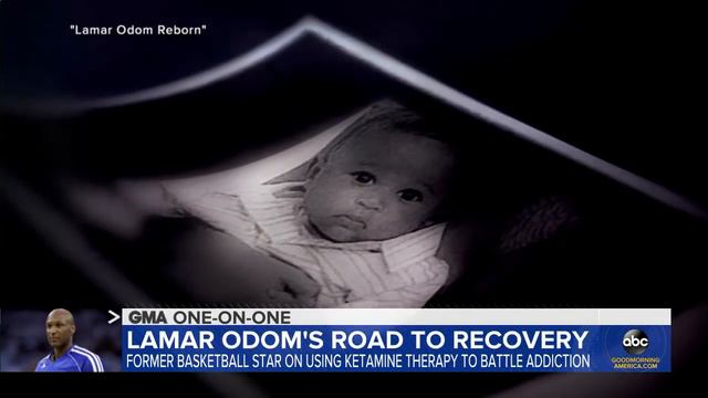 Lamar Odom talks experimental treatment helping his recovery l GMA смотреть онлайн