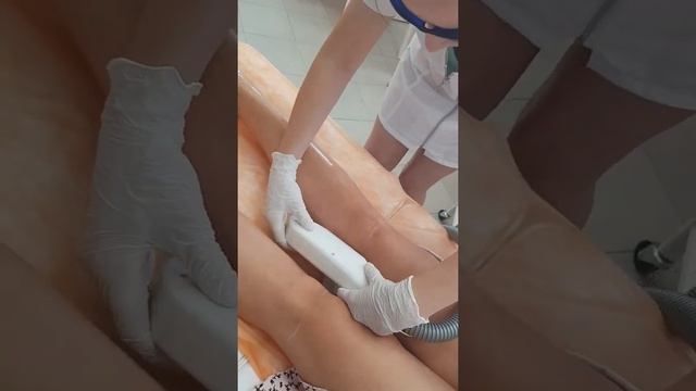 Yarko. Лазерная эпиляция ноги до колена(голени) смотреть онлайн