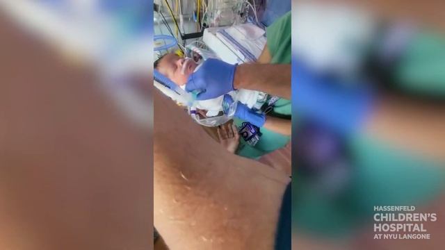 CHAOS and EXIT Procedure: Baby Aydin's Story смотреть онлайн