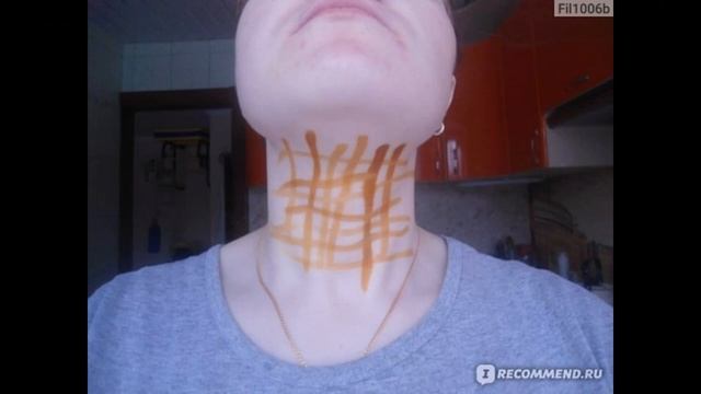 ЧТО ЛЕЧИТ ЙОДОВАЯ СЕТКА И КАК ЕЕ ПРАВИЛЬНО НАНОСИТЬ смотреть онлайн