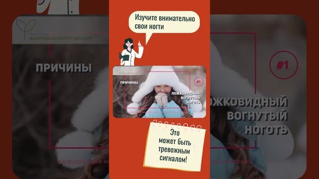 Вогнутые и половинные ногти расскажут о ваших проблемах со здоровьем смотреть онлайн