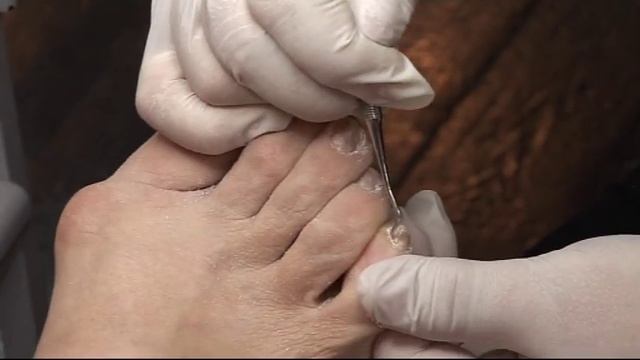 Аппаратный педикюр смотреть онлайн