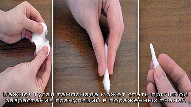 Как делать турунды в уши смотреть онлайн