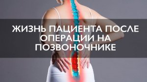 Лечение стеноза позвоночника | Жизнь пациента после операции