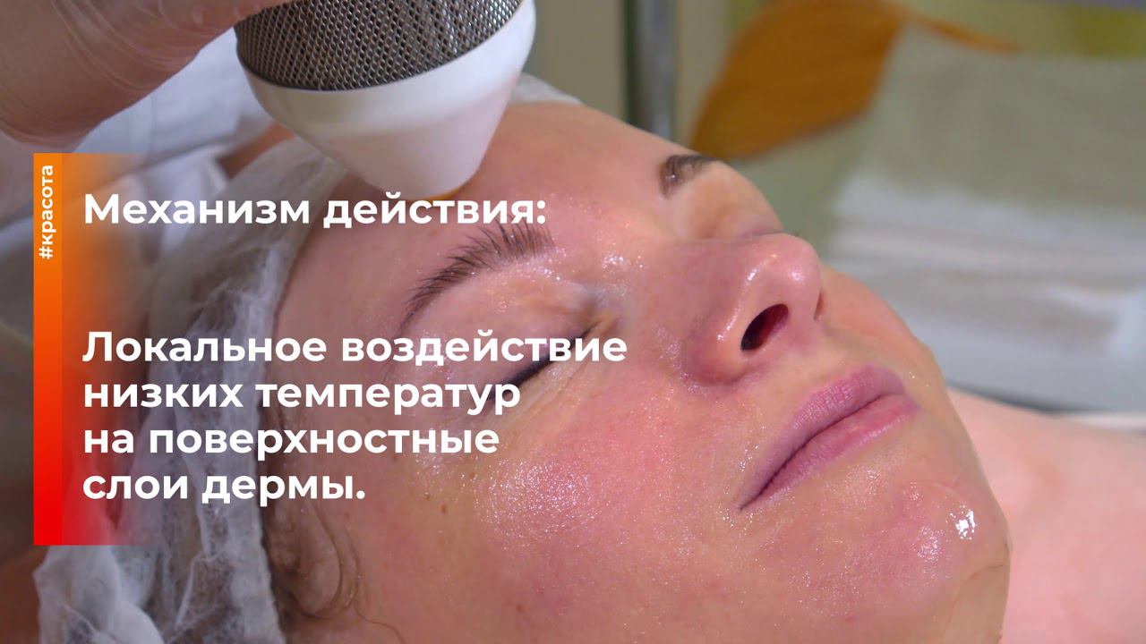 Процедура криолифт. Косметолог-эстетист Козинцева Елена смотреть онлайн