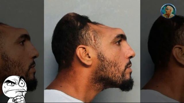 Карлос Родригес  человек без мозга / Удивительный феномен человека