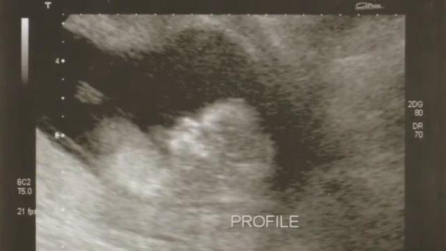 Eller Baby Slideshow смотреть онлайн