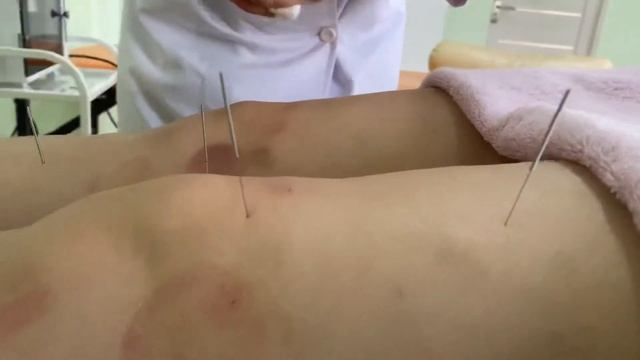 Климакс кезіндегі ем-шаралар. смотреть онлайн