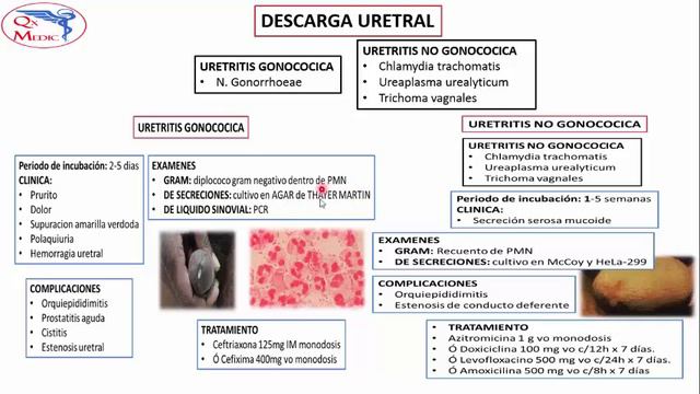 10 SAN ISIDRO VIRTUAL INFECTO A 10 ITS смотреть онлайн