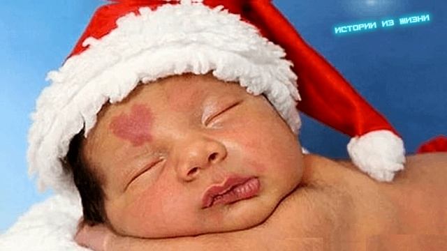 Малыш родился с родимым пятном в виде СЕРДЦА на лбу! Взгляните что с ним стало... смотреть онлайн