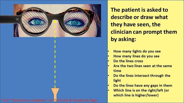 Bagolini striated glass test смотреть онлайн