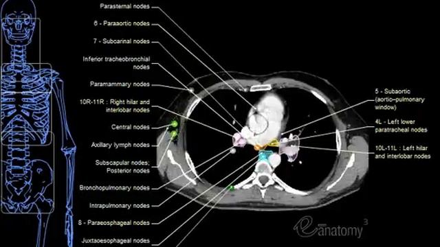 eAnatomy - Mediastinal Lymph Nodes (Hi Qual).mov смотреть онлайн