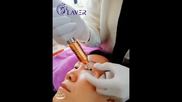 Hyaluron Pen For Eye Lifting