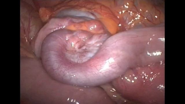 7.11.2020 19:15 «Избранные вопросы хирургии для педиатров» смотреть онлайн