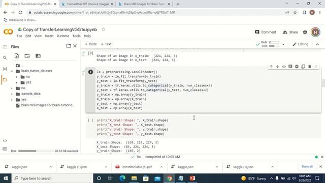 Deep-learning in Health care || Image Classification using(VGG16)? смотреть онлайн