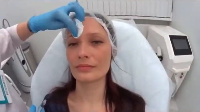 Ботулинотерапия в Екатеринбурге - Lerden центр эстетической косметологии (часть 2) смотреть онлайн