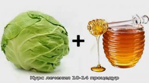 Как лечить бурсит коленного сустава в домашних условиях