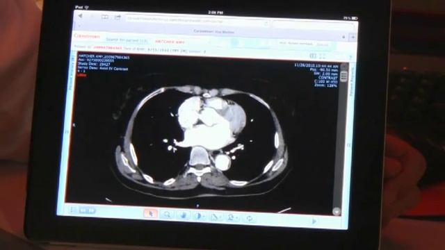New Features for Carestream's Vue Motion Image Viewer смотреть онлайн