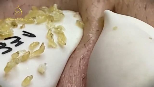 Relaxing Every Day With LOAN NGUYEN SPA DaNang #44Черные точки смотреть онлайн