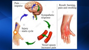 2.35. Массаж при КРБС. Массаж при нервно-мышечных заболеваниях | Медицинский массаж. Цикл 2