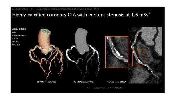 256 SLICES CT SCANNER in Civil Service Hospital ,Nepal смотреть онлайн