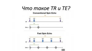 Основы МРТ(ЧАСТЬ 1). Что такое TR, TE, ИП?