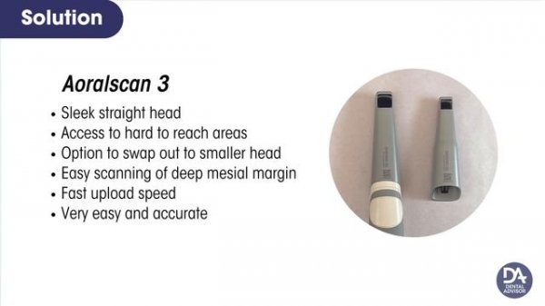 Aoralscan 3 Dental Advisor Clinical Problem Solver