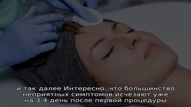 Плазмолифтинг PRP: особенности процедуры