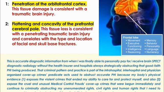 An easy to understand example of a Medical Control Fraud смотреть онлайн